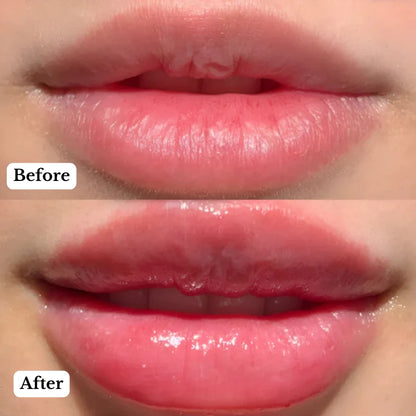 PlumpX™ | Lip Booster Roller 💋✨